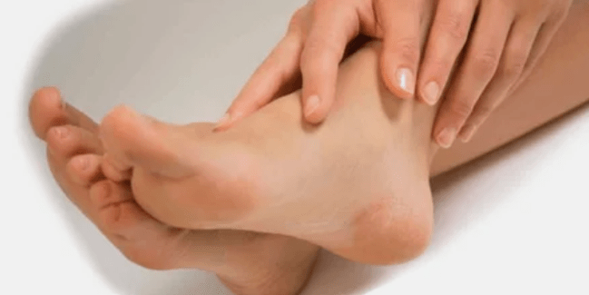 Treatment of nail fungi