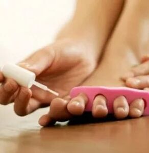 Application of therapeutic varnish